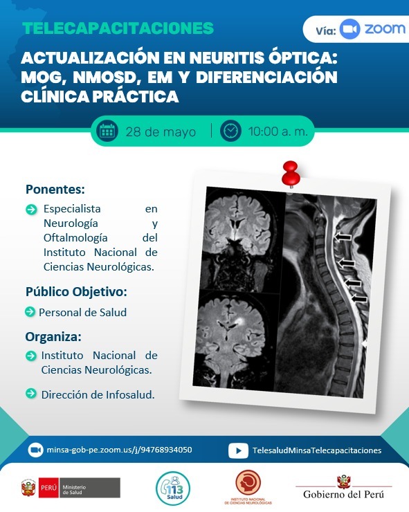 ACTUALIZACIÓN EN NEURITIS ÓPTICA: MOG, NMOSD, EM Y DIFERENCIACIÓN CLÍNICA PRÁCTICA
